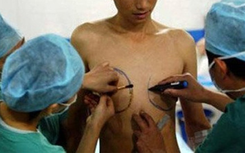 Ngày càng có nhiều người đã thực hiện việc chuyển giới ở nước ngoài về nước, làm phát sinh nhiều vấn đề pháp lý, xã hội liên quan đến việc thực hiện quyền, nghĩa vụ dân sự của những người chuyển giới - Ảnh minh họa.<br>