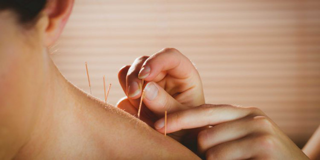 Những bí mật của liệu pháp trị bệnh bằng kim - Ảnh 2.