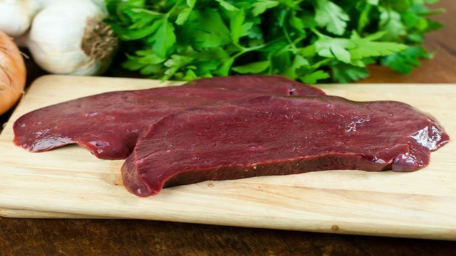 14 thực phẩm chứa nhiều cholesterol cao nên tránh - Ảnh 2.