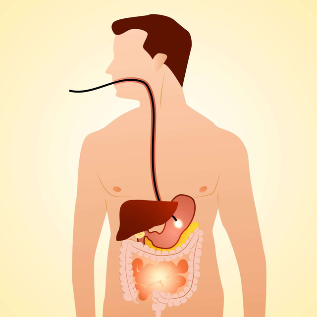 Ứng dụng AI vào điều trị bệnh lý tiêu hoá - Ảnh 1.