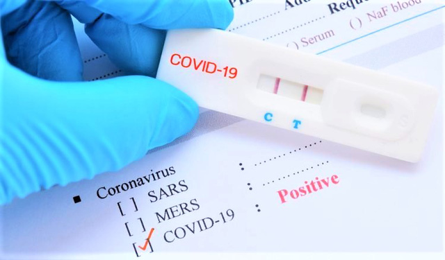 Muốn đưa test nhanh Covid-19 vào diện bình ổn giá phải được PG88 ⭐ Link trang chủ số 1 nhà cái PG88 com casino slot thông qua