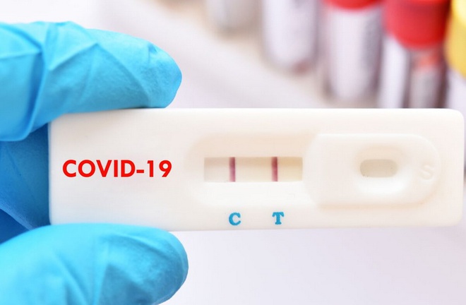 Từ 21/2, giá test nhanh Covid-19 tối đa 78.000 đồng/xét nghiệm