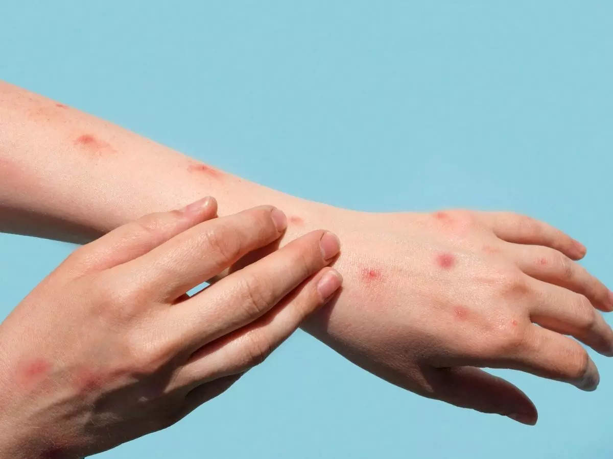 C&oacute; vẻ như đ&atilde; c&oacute; một số sự kiện g&acirc;y ph&aacute;t t&aacute;n virus rộng v&agrave; tạo điều kiện cho bệnh l&acirc;y lan nhanh sang nhiều quốc gia.