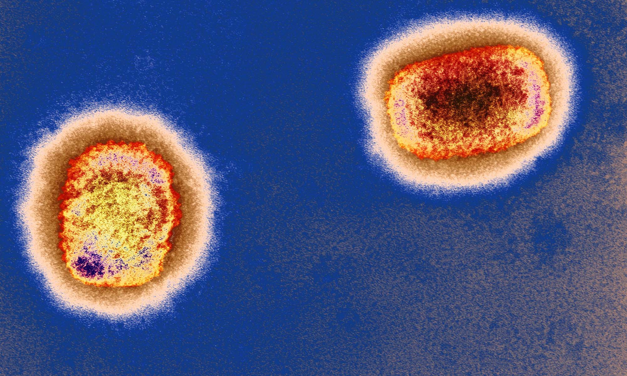 Nh&oacute;m chuy&ecirc;n gia tại Đức ph&aacute;t hiện virus đậu m&ugrave;a khỉ tồn tại nhiều nhất tr&ecirc;n bề mặt ph&ograve;ng tắm, &aacute;o sơ mi, vỏ gối...