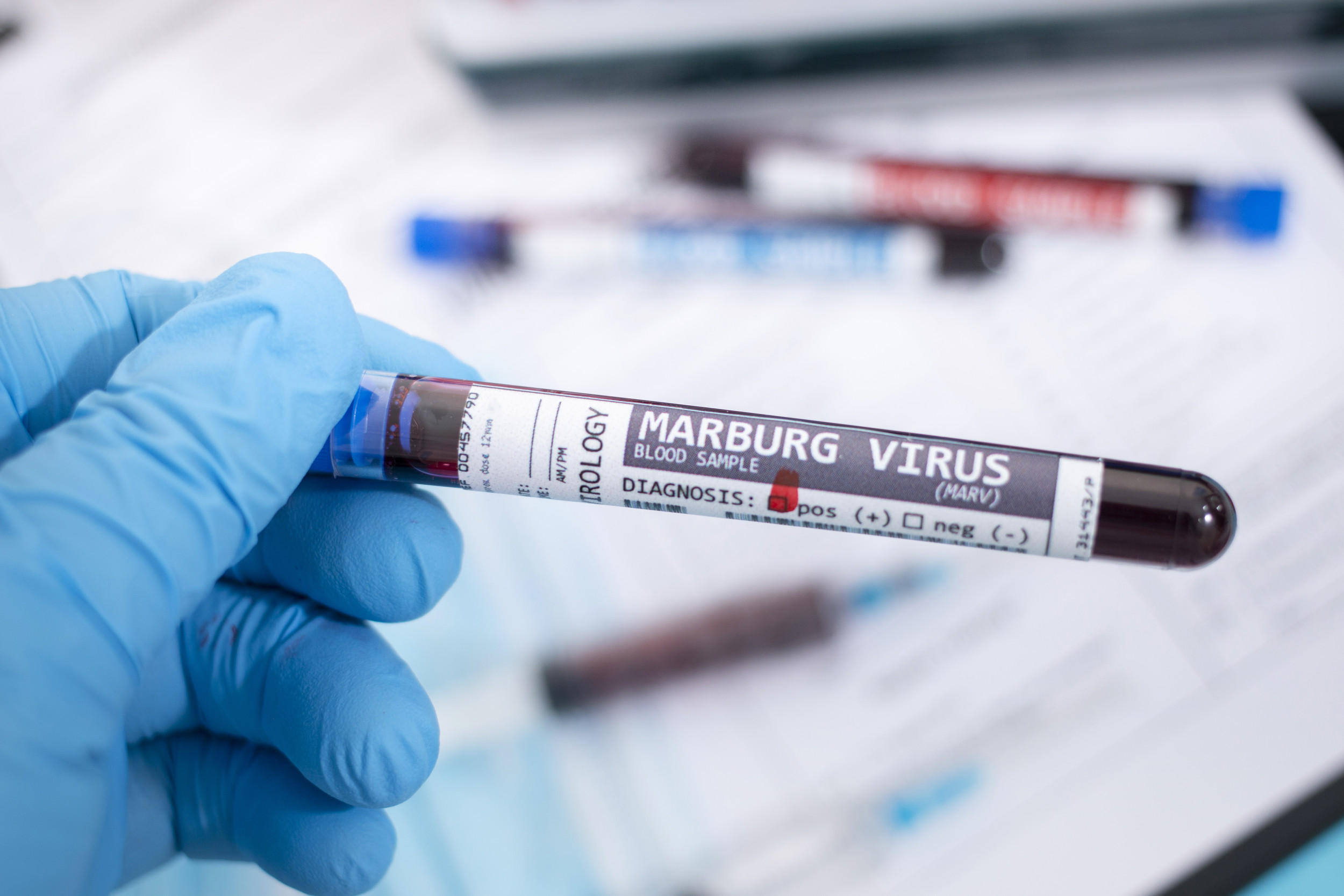 Virus Marburg: Cảnh báo nguy cơ dịch chồng dịch