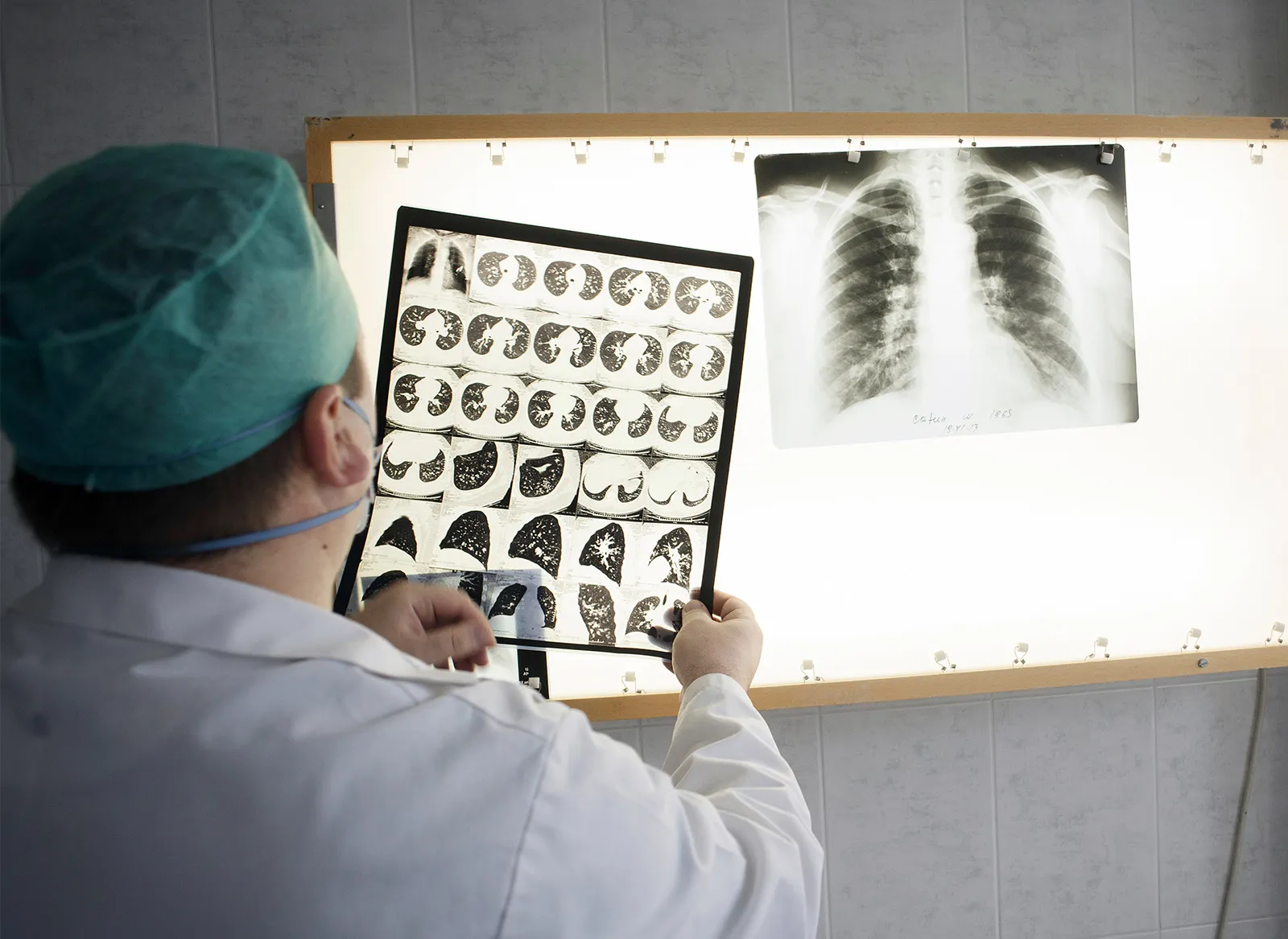 Việc ứng dụng AI trong việc tầm so&aacute;t bệnh lao được chứng minh l&agrave; hiệu quả trong việc r&uacute;t ngắn thời gian chẩn đo&aacute;n, tăng cường độ ch&iacute;nh x&aacute;c...