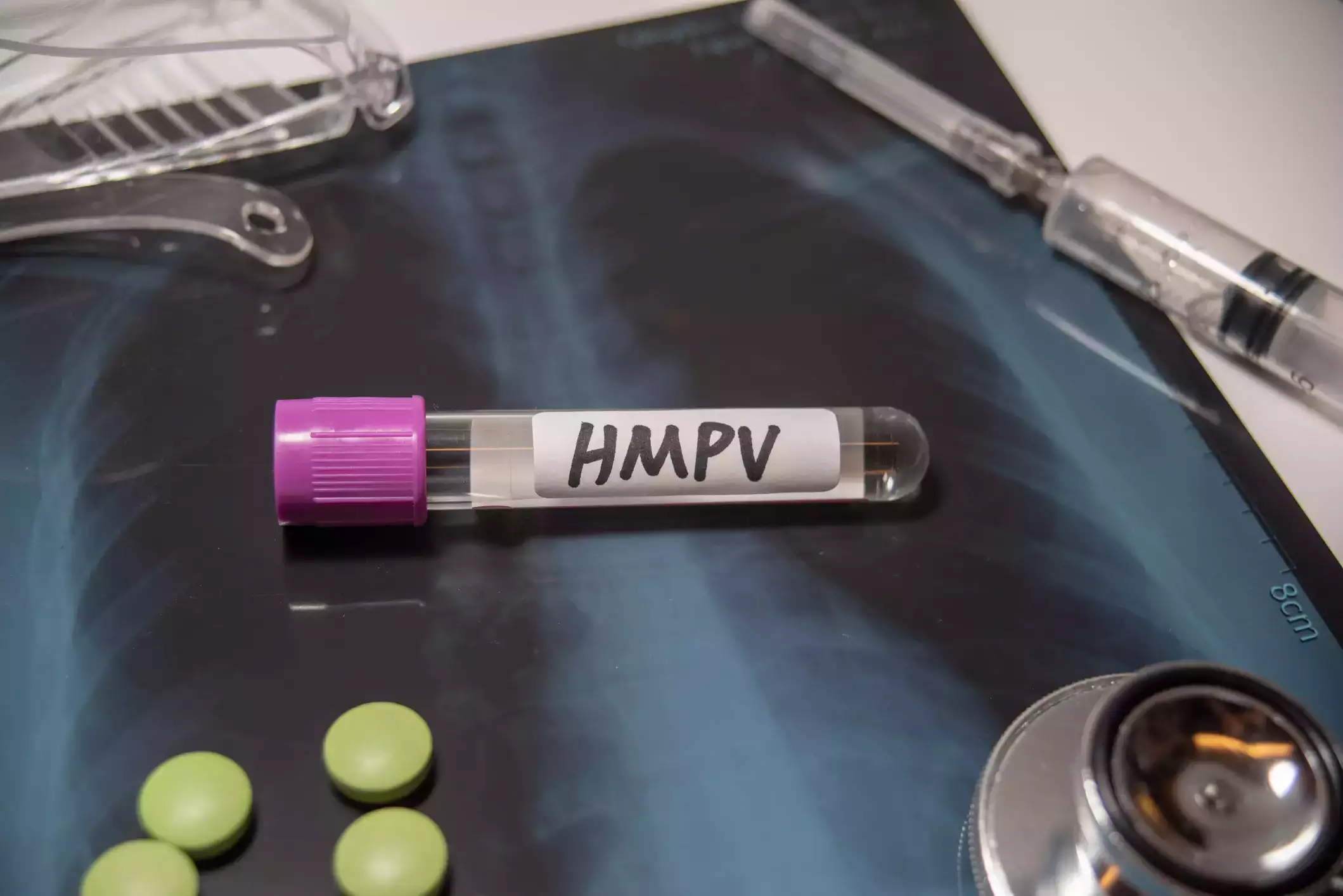 Virus gây bệnh hô hấp ở Trung Quốc có giống Covid-19?