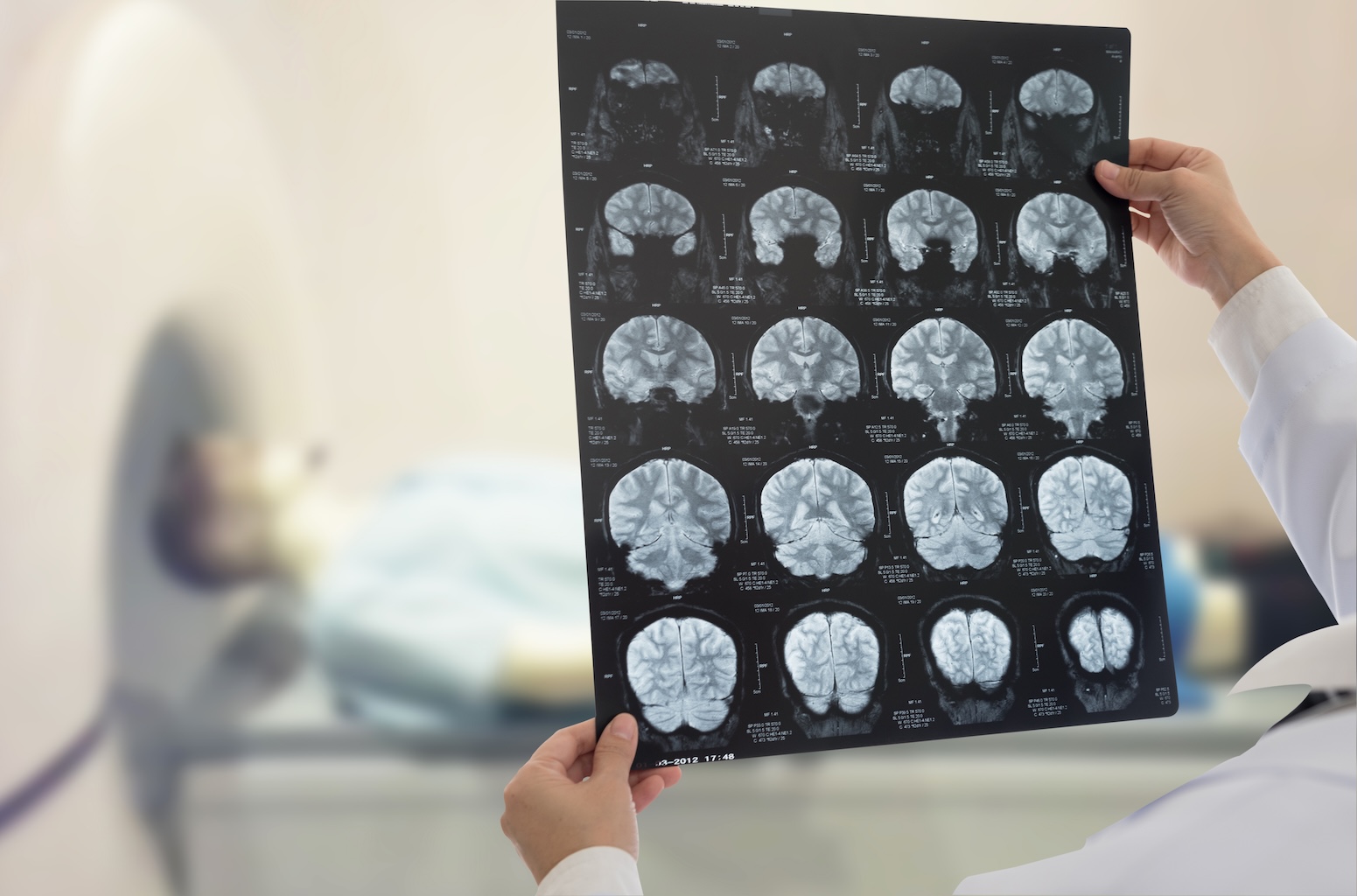 AI sẽ là công cụ quan trọng giúp bác sĩ phát hiện sớm nguy cơ và người bệnh chủ động phòng ngừa.&nbsp;