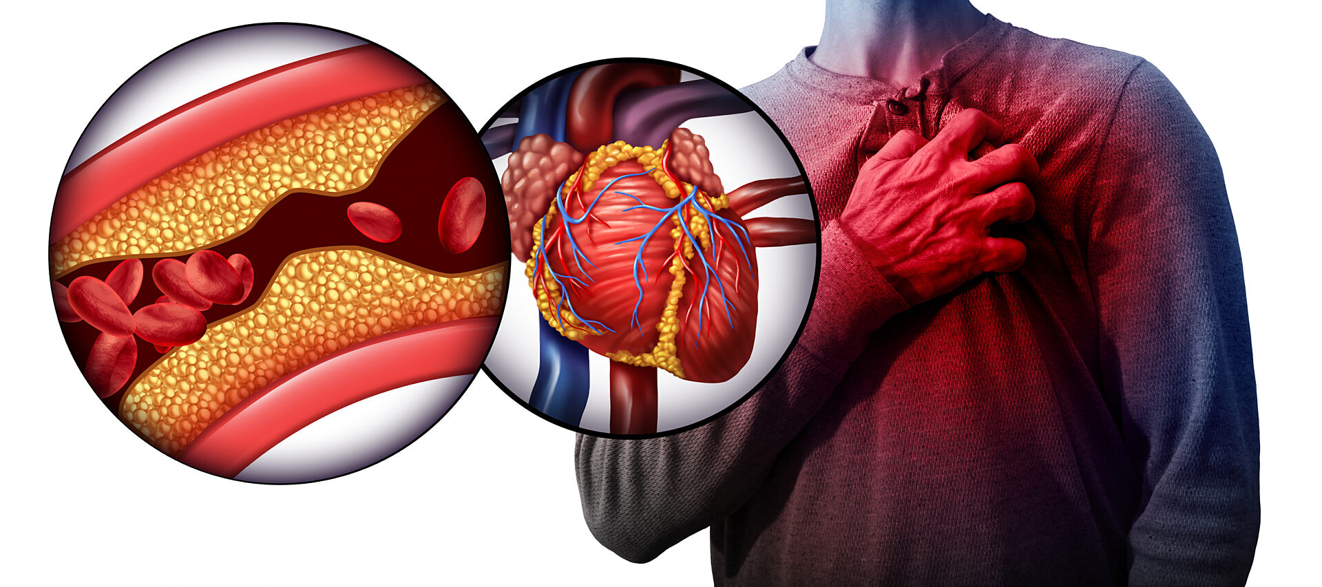 Thay đổi nhiệt độ đột ngột có thể gây co mạch ngoại biên và mạch vành, làm tăng huyết áp và nhu cầu oxy của tim.