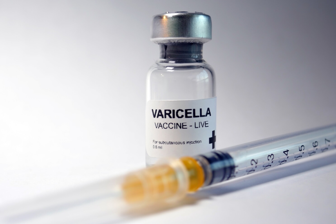 Vaccine thủy đậu là biện pháp hiệu quả với tỷ lệ bảo vệ đến 98%.