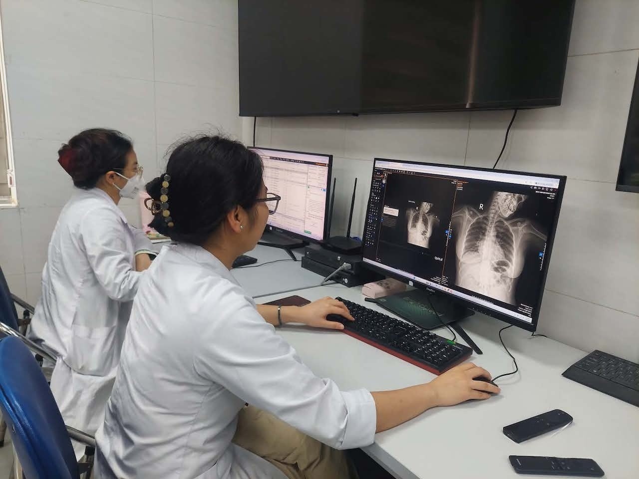 Các bác sĩ Bệnh viện Ung bướu Hà Nội áp dụng AI trong đọc kết quả phim.&nbsp;