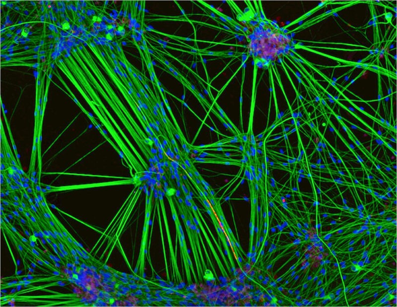 Các neuron người được nuôi cấy trong phòng thí nghiệm, hiển thị mạng lưới kết nối phức tạp giữa các tế bào thần kinh - nền tảng cho các nghiên cứu điện toán sinh học và Link Đăng Nhập PG88 Chính Thức 2026; “wetware”. Nguồn: Nikon Small World/Leica Microsystems