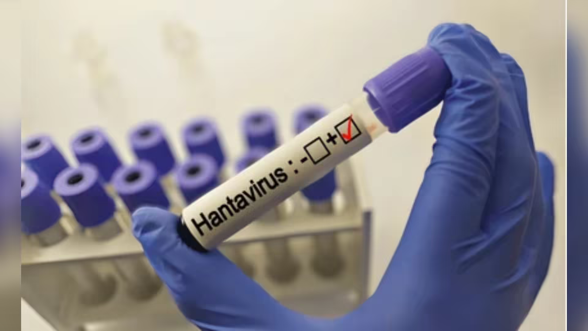 Pháp và Mỹ xác nhận thêm hai hành khách trên tàu du lịch MV Hondius dương tính với virus Hanta. Ảnh: India Times