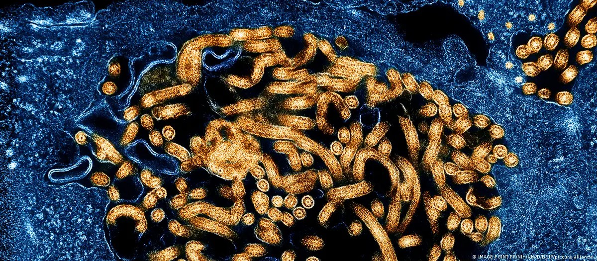 Ebola, được cho là có nguồn gốc từ loài dơi, có thể gây xuất huyết nghiêm trọng và suy đa cơ quan. Ảnh: Mage Point FR