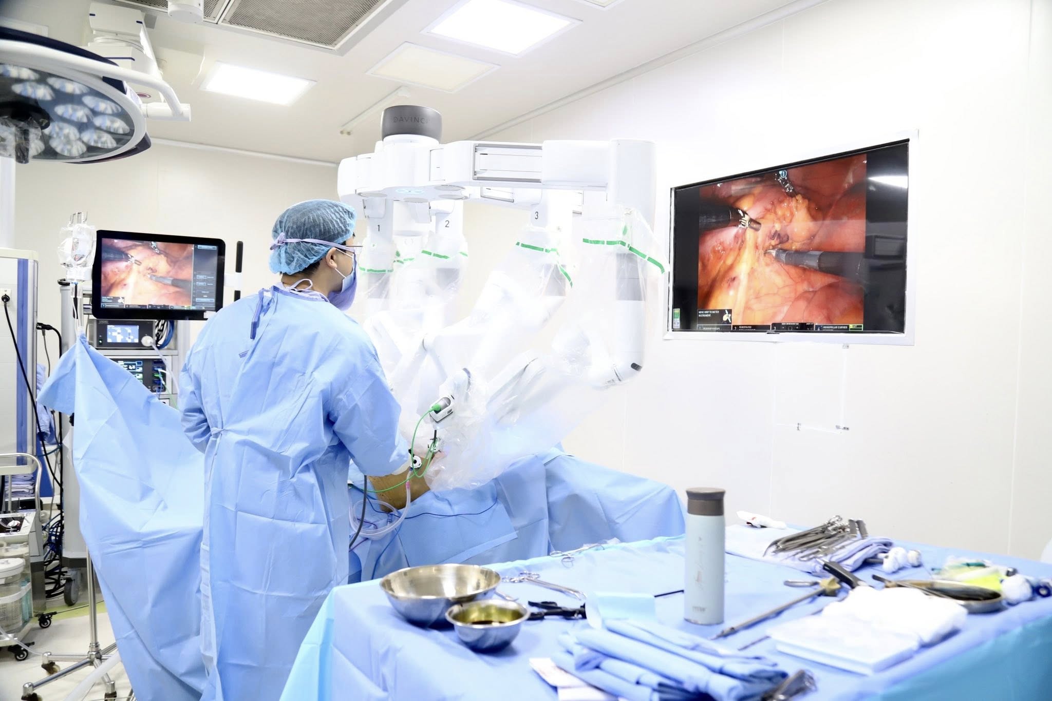 Các bác sĩ Bệnh viện K&nbsp;phẫu thuật nội soi robot cho người bệnh.