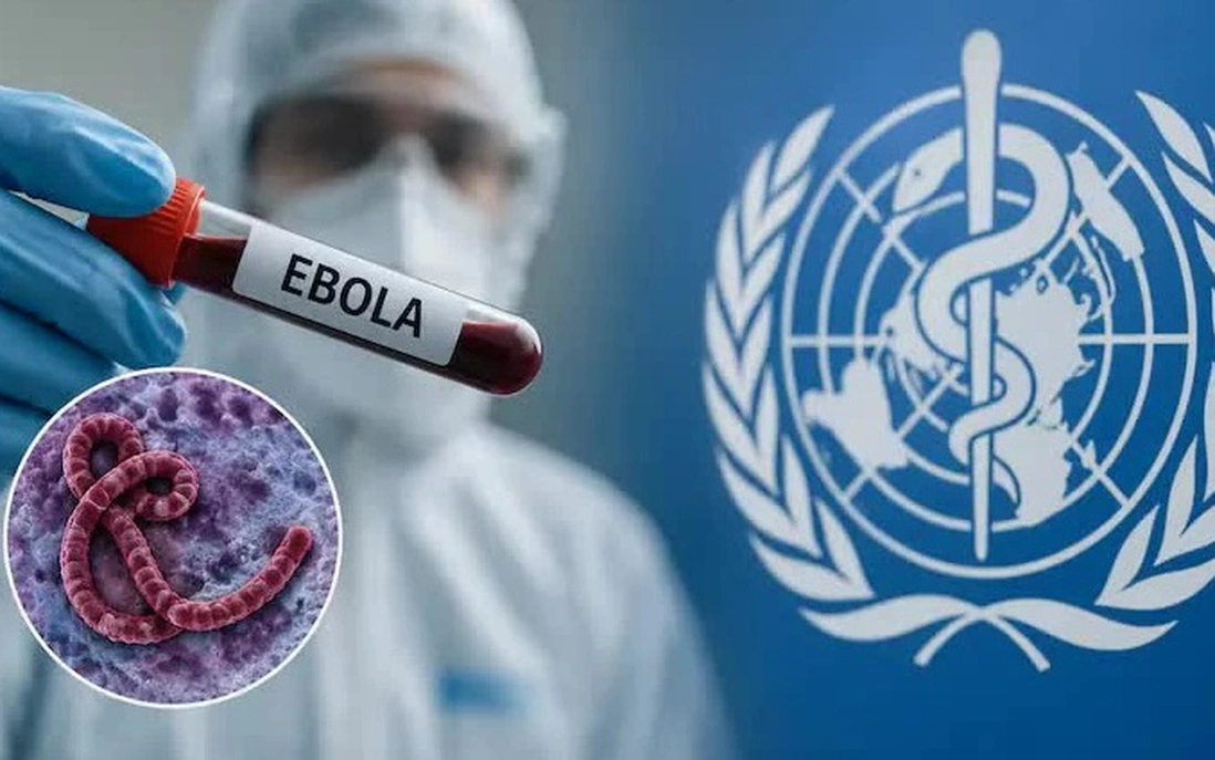 Bộ Y tế đề nghị siết chặt kiểm soát dịch Ebola tại các cơ sở y tế